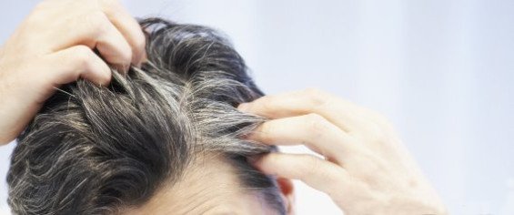Причини, чому сивіє волосся у чоловіків