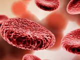 Железодефицитная анемия: как противодействовать недостатку микроэлемента в организме