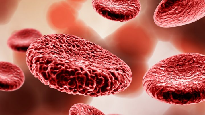 Железодефицитная анемия: как противодействовать недостатку микроэлемента в организме