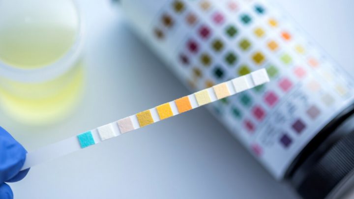 Домашние и лабораторные анализы на наркотики: преимущества и ограничения